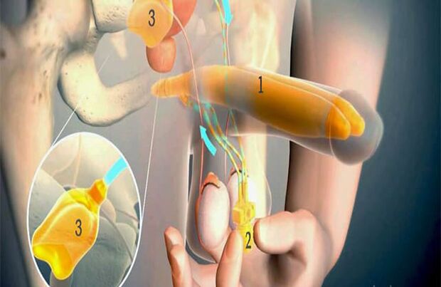 Operațiune de lipofilling