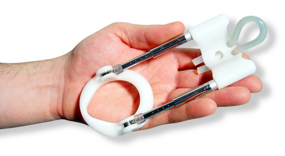Un extender este un dispozitiv bazat pe principiul întinderii țesutului penian